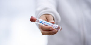일본 STSS 전염병을 우려한 예방접종 시약을 들고 있는 손